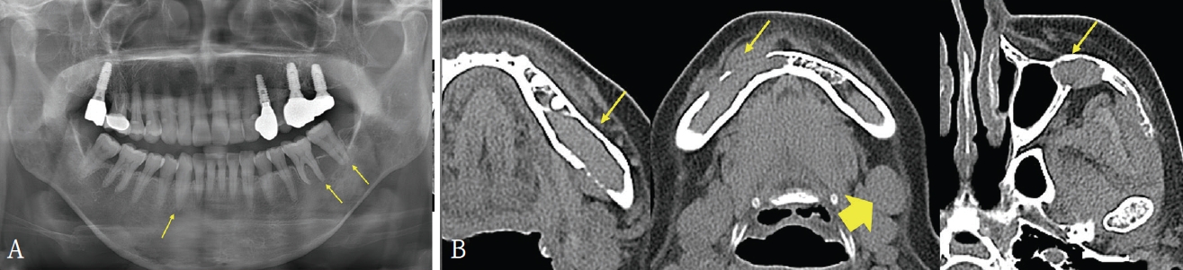 Fig. 3.